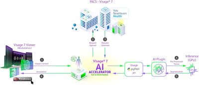 Clinical implementation of artificial intelligence in neuroradiology with development of a novel workflow-efficient picture archiving and communication system-based automated brain tumor segmentation and radiomic feature extraction